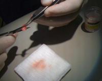 this is the object found in my arm after a close encounter at skinwalker ranch