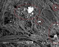 electron microscope photo of strange object found in my arm after visit to skinwalker